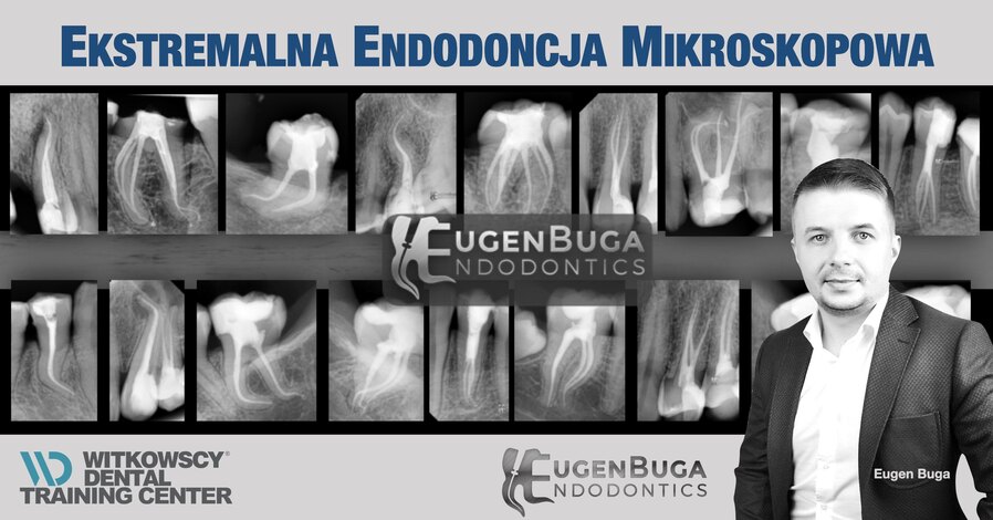 Ekstremalna Endodoncja z Eugenem Bugą